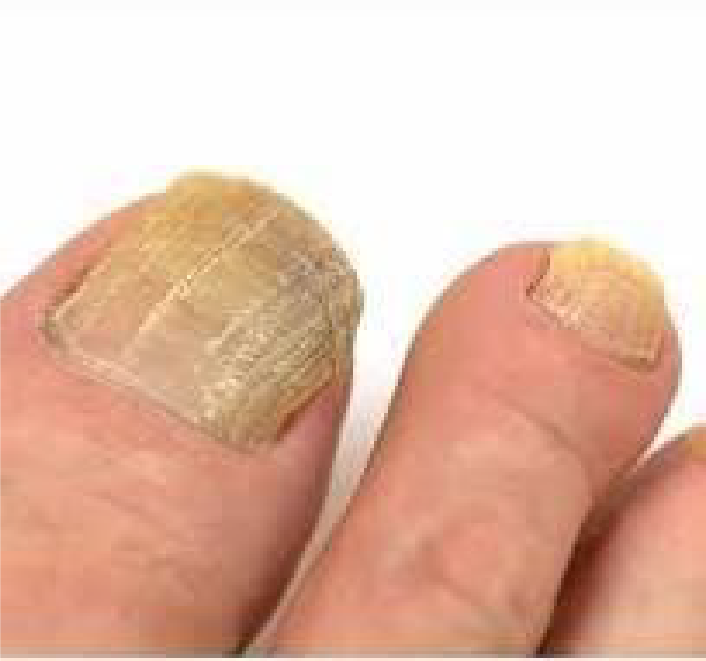 EcoMedi otthoni használat